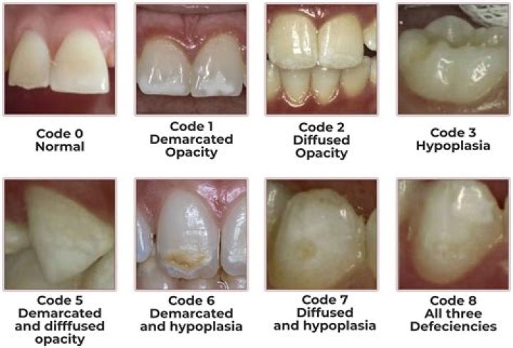 What are the defects in structure?